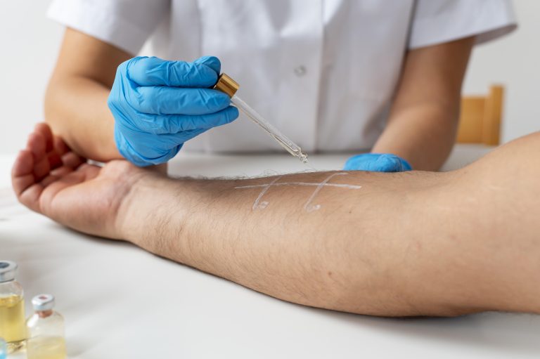 doctor-checking-person-s-skin-allergy